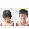 蘭州提供專業(yè)的隱形補發(fā)|蘭州哪家補發(fā)比較好